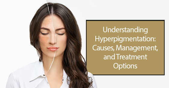 Understanding hyperpigmentation: Causes, management, and treatment options